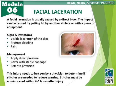 411A - Laceration without foreign body of right hand, initial encounter. . Laceration to face icd 10